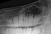 Röntgenbild der Backenzähne 